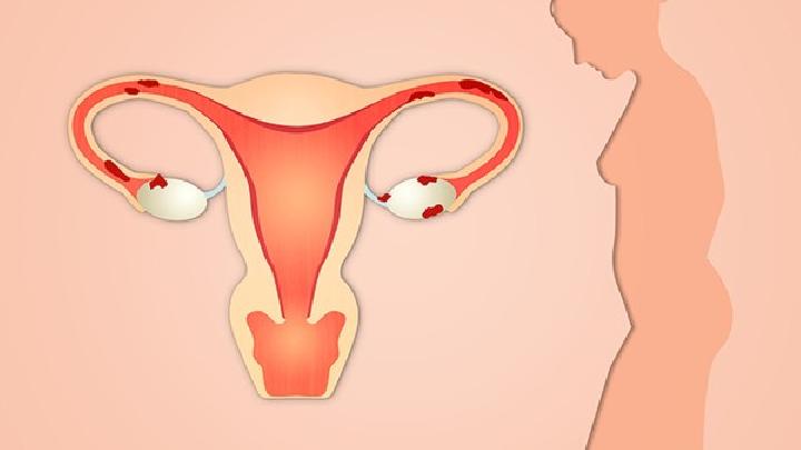 2024年多囊卵巢综合征能试管代怀微信号吗